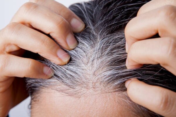 know the causes of white hair and easy ways to prevent it naturally